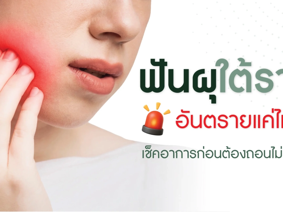 ผู้หญิงจับแก้มเพราะปวดฟันจากอาการฟันผุใต้ราก พร้อมข้อความ “ฟันผุใต้ราก อันตรายแค่ไหน เช็กอาการก่อนต้องถอนไม่รู้ตัว”