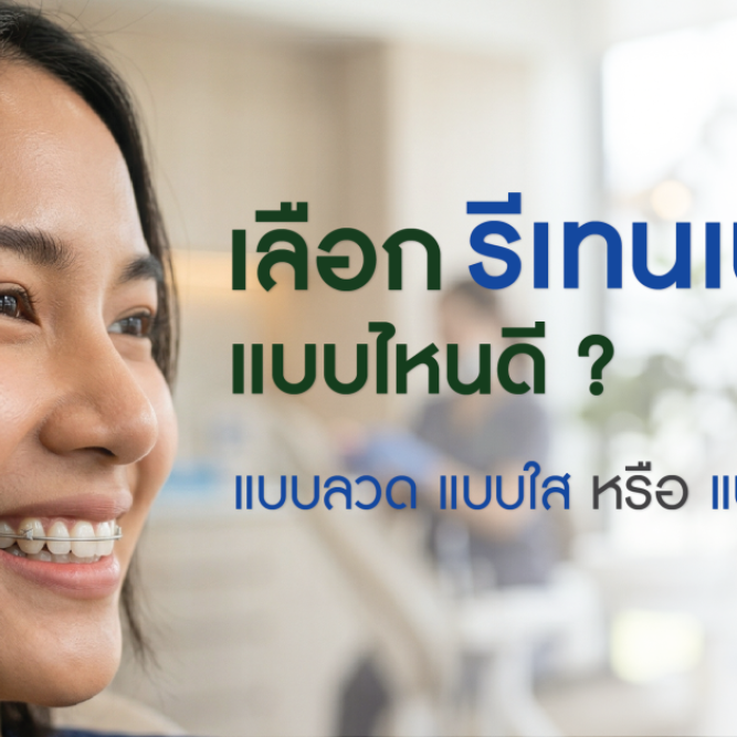 เลือกรีเทนเนอร์แบบไหนดี ผู้หญิงใส่รีเทนเนอร์ลวดขณะยิ้ม มุมข้าง