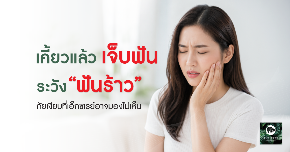 pain-when-chewing-cracked-tooth-featured-image