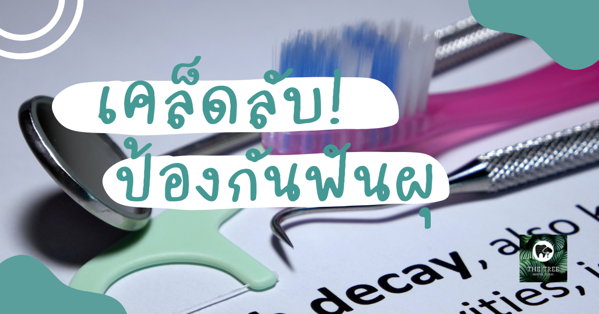 เคล็ดลับป้องกันฟันผุ (2)